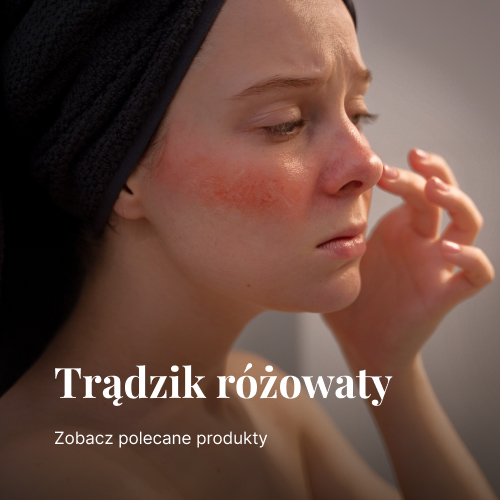 Trądzik różowaty