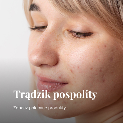 Trądzik pospolity